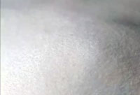 Sugar PSA